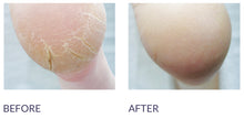 Load image into Gallery viewer, Footlogix CRACKED HEEL FORMULA mousse