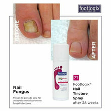 Load image into Gallery viewer, Anti-Fungal spray Footlogix
